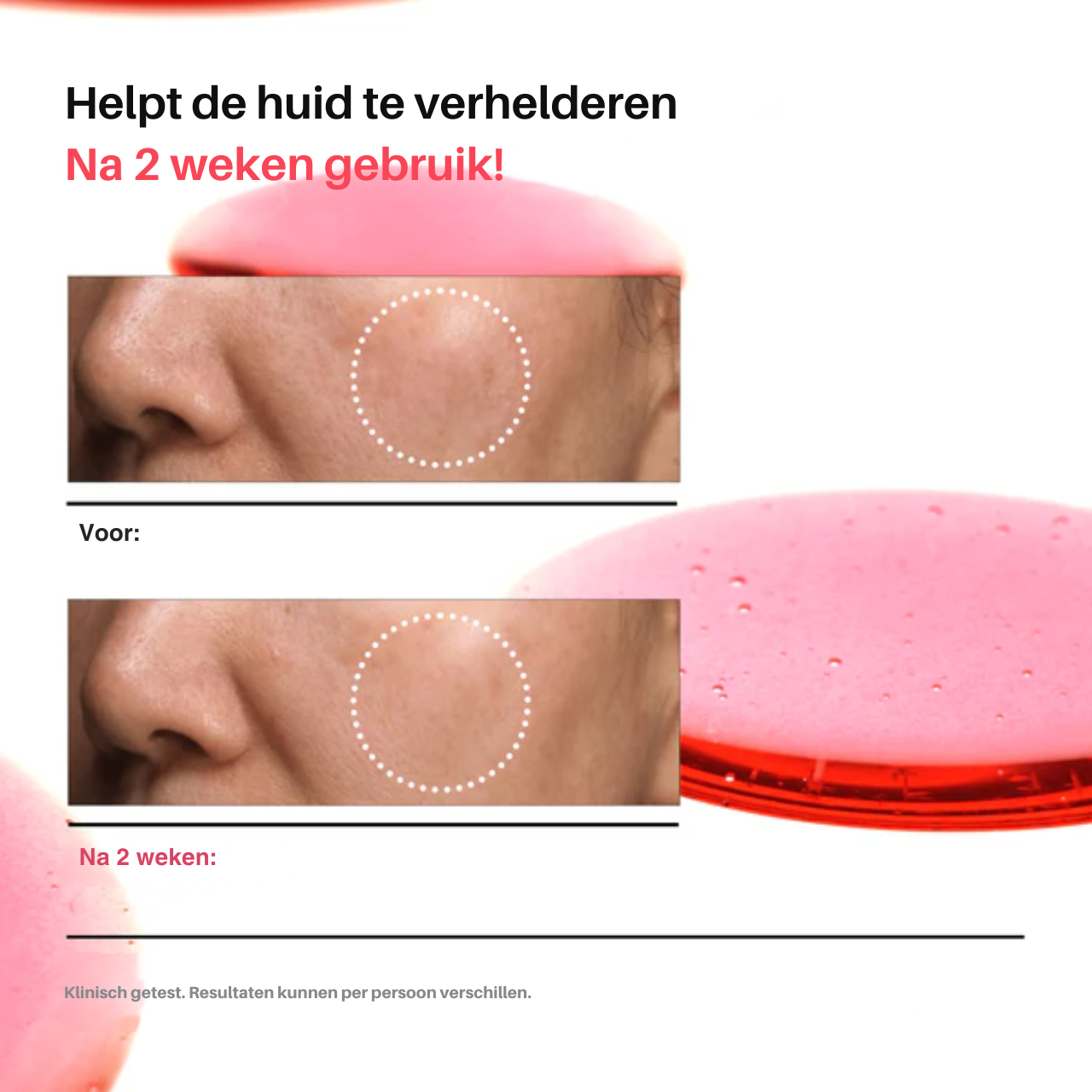 Niacinamide 10%+TXA 4% Serum
